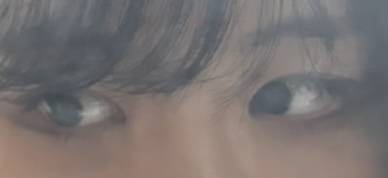 [잡담] 나 쌍수할까 말까 | 인스티즈