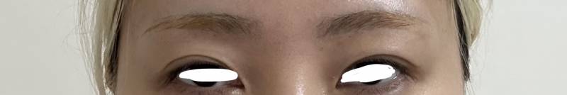 [잡담] 이거 눈이랑 눈썹 사이 가까운거야? | 인스티즈