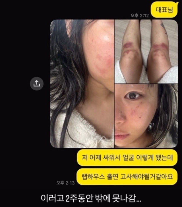 [잡담] '데이트폭력 폭로' 재키와이·방달, 백허그+입맞춤 근황 '재결합 암시' 반전[이슈S] | 인스티즈