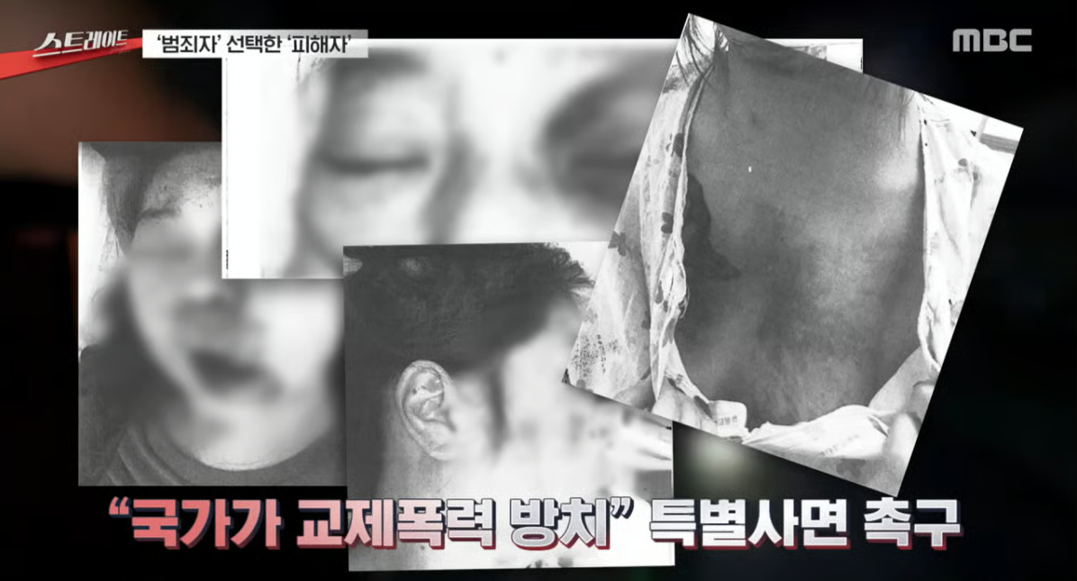 교제폭력 31번, 얼굴함몰·담…"살고 싶어" 방화살인범 된 여성 | 인스티즈