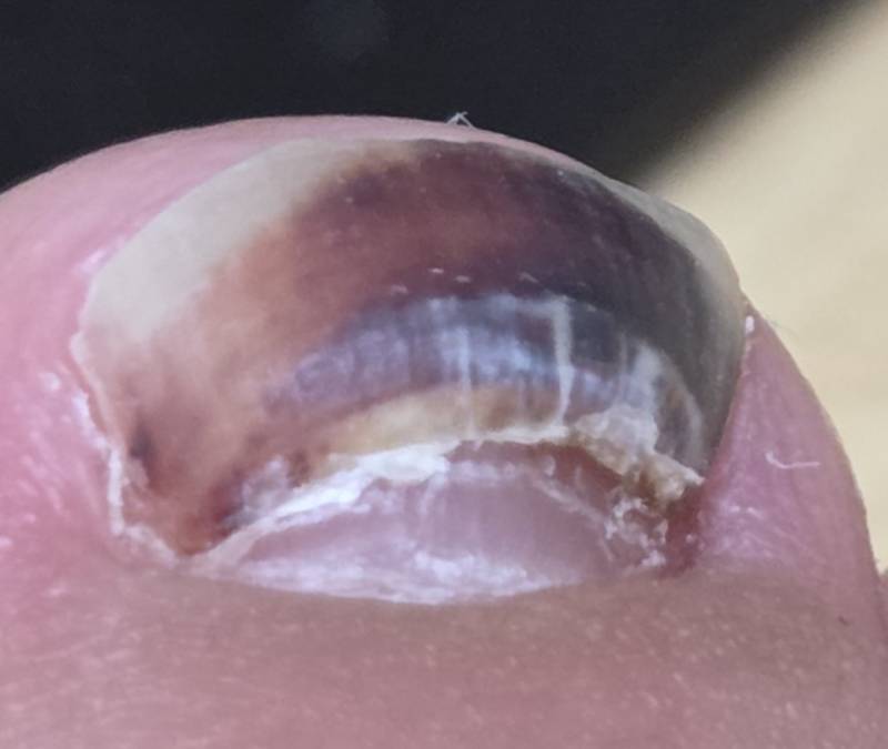 [잡담] (ㅎㅇㅈㅇ)여행갔을땐 꼭 편한 신발을 신도록 해 | 인스티즈