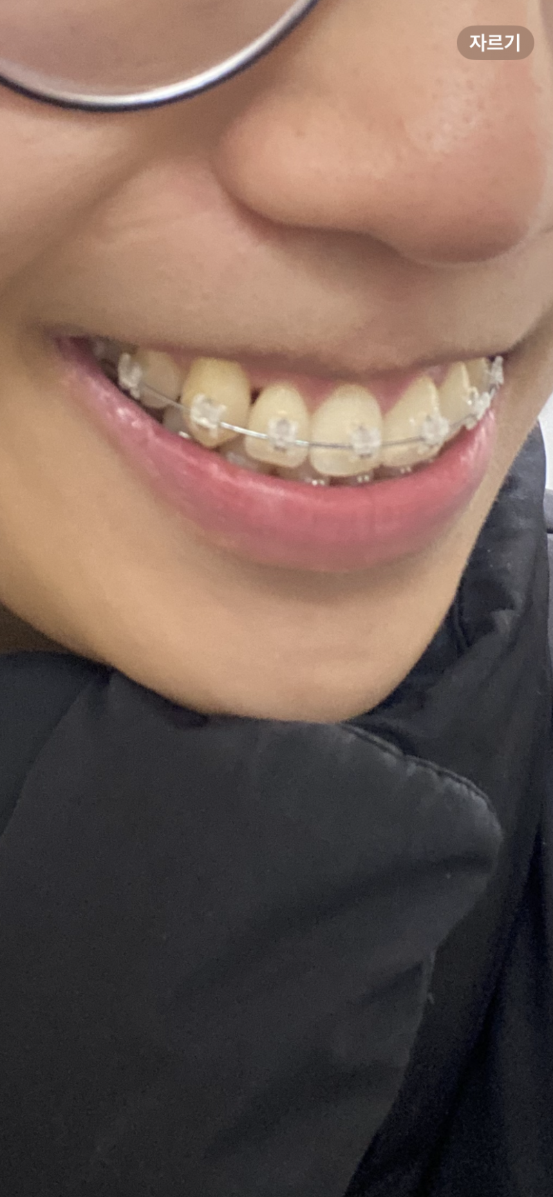 [잡담] 블랙트라이앵글 레진할까 (제발 답해조,,) | 인스티즈