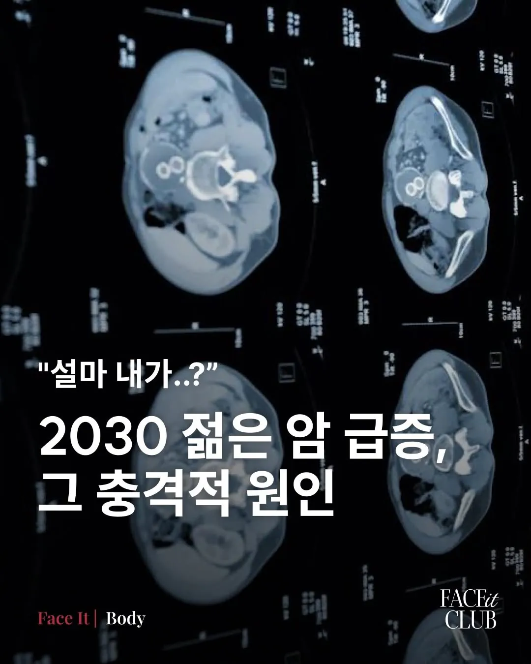 현재 국가가 나서야할 수준이라는 MZ 대장암..JPG | 인스티즈