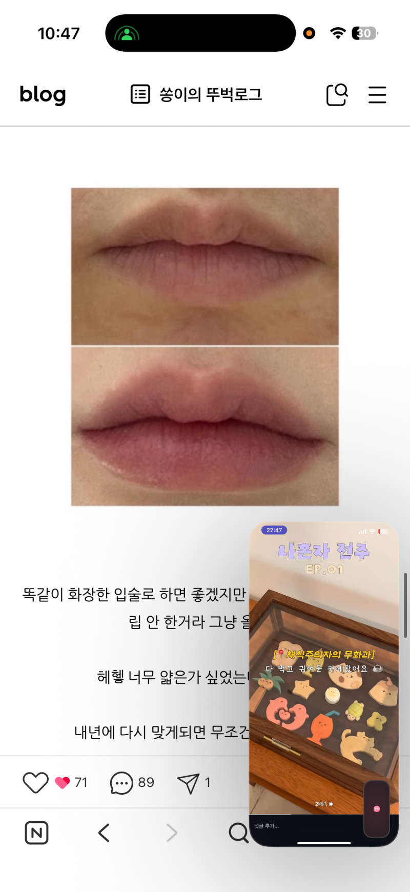 [잡담] 님들아 나 입술 필러좀 봐주셈🙏 | 인스티즈