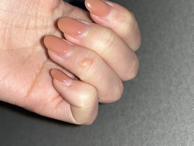 [잡담] 얘두라이거 곪은거지... ㅎㅇㅈㅇ | 인스티즈