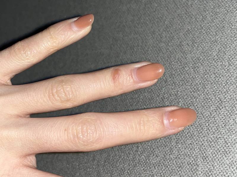 [잡담] 얘두라이거 곪은거지... ㅎㅇㅈㅇ | 인스티즈