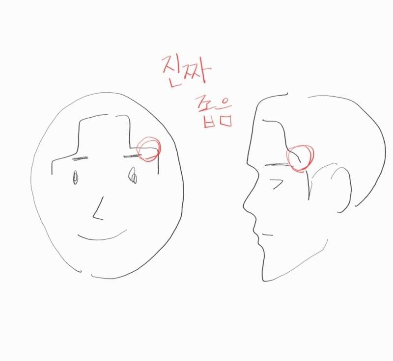 [잡담] 헤어라인 고민 | 인스티즈