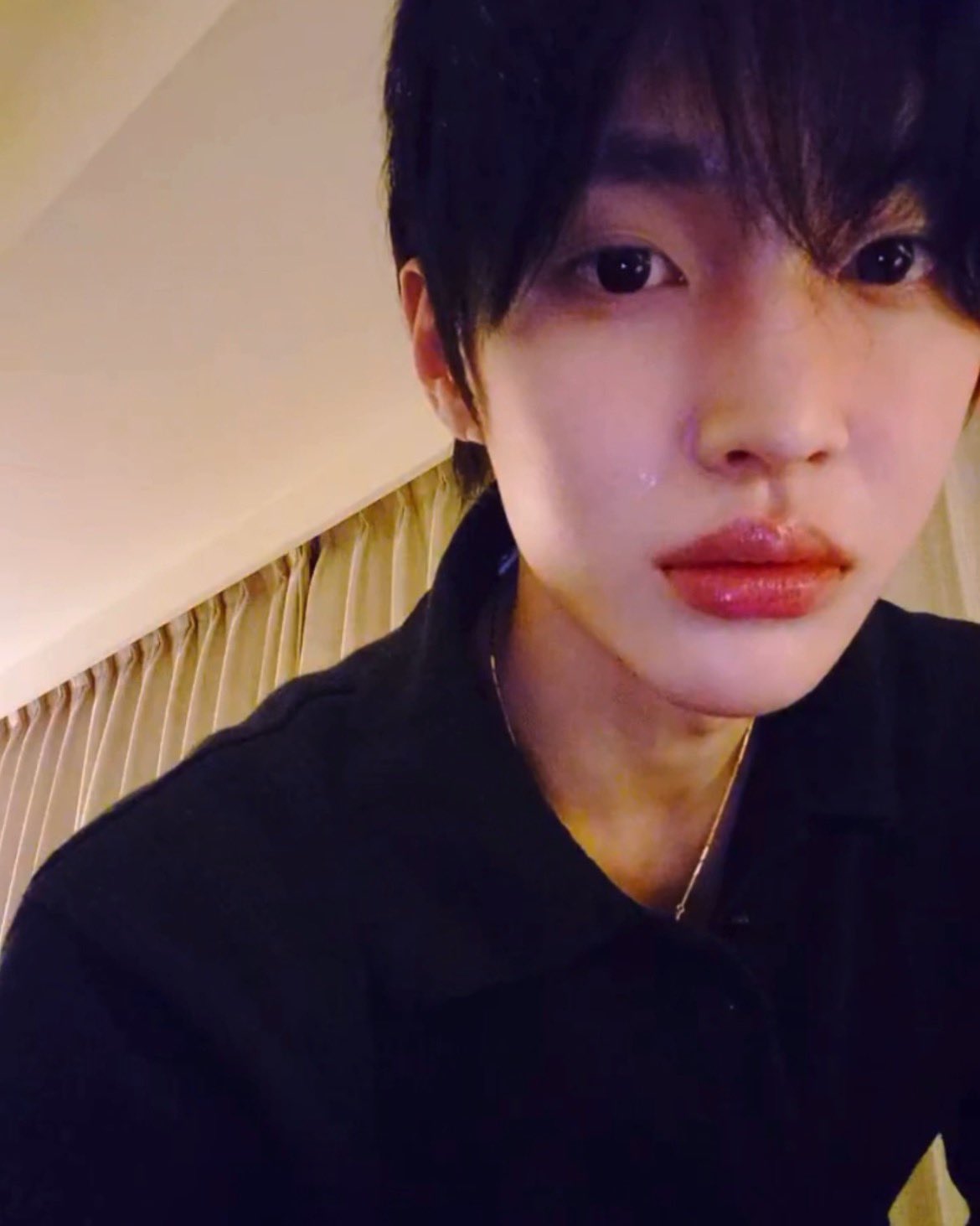 [잡담] 라이즈 원빈 입술 비포앤애프터 | 인스티즈