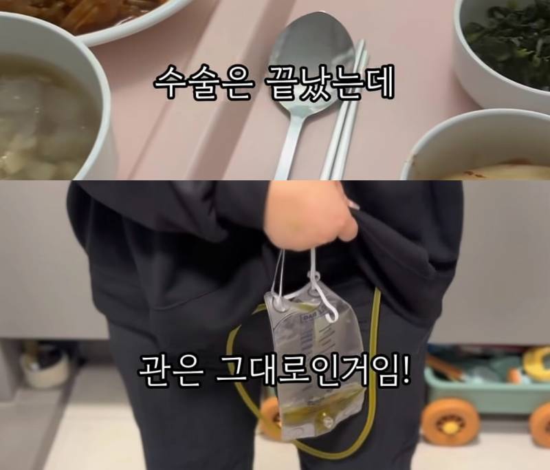 (충격주의) 위고비 마운자로 맞고 배에 구멍..JPG | 인스티즈