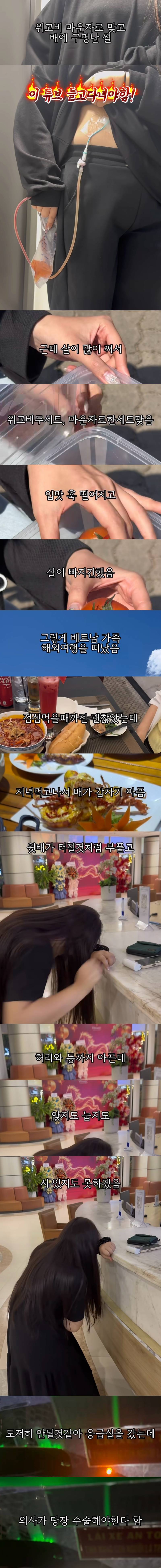 (충격주의) 위고비 마운자로 맞고 배에 구멍..JPG | 인스티즈