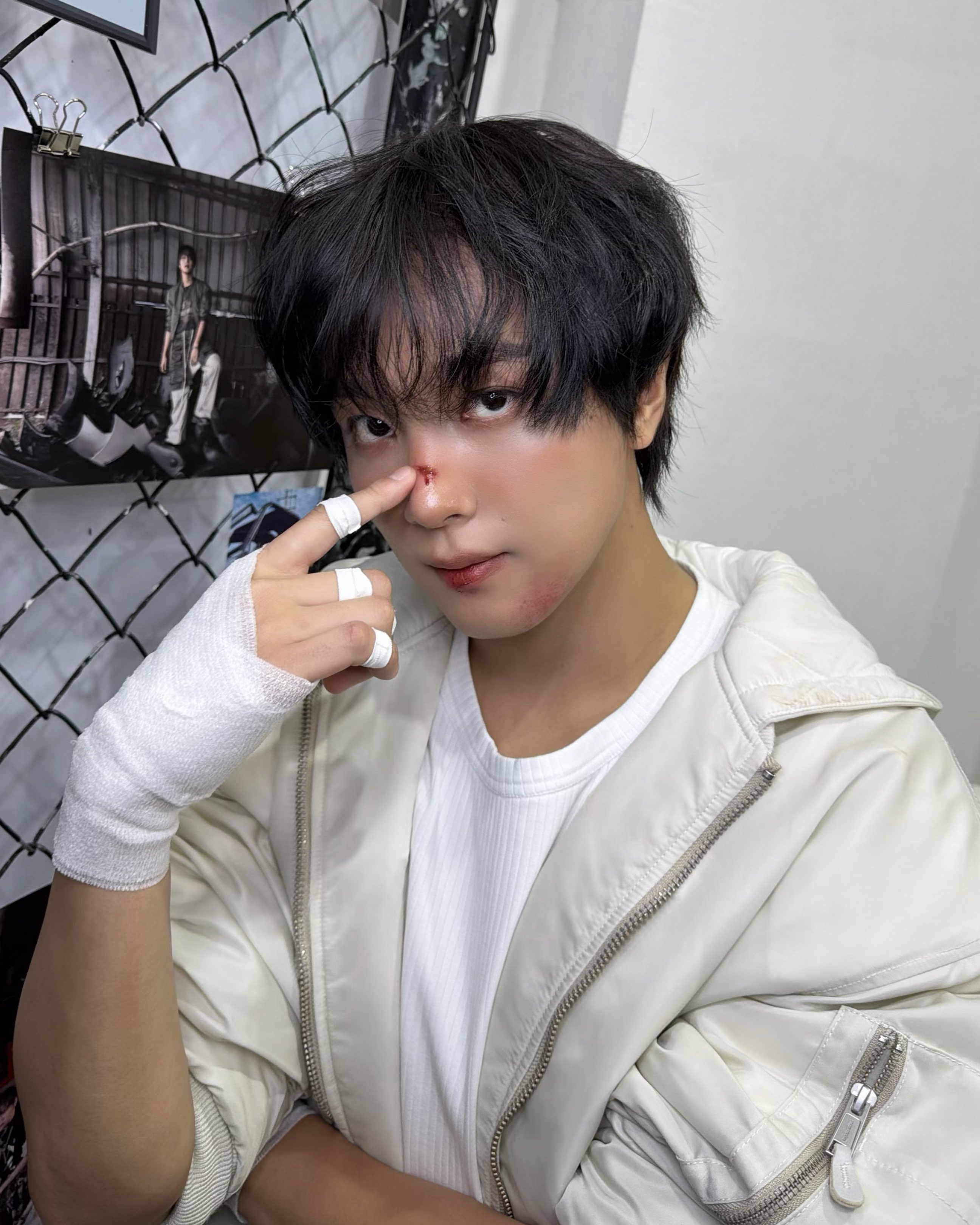 [잡담] 해찬이 나이 먹을수록 상처 분장하면 더 귀여워짐 | 인스티즈
