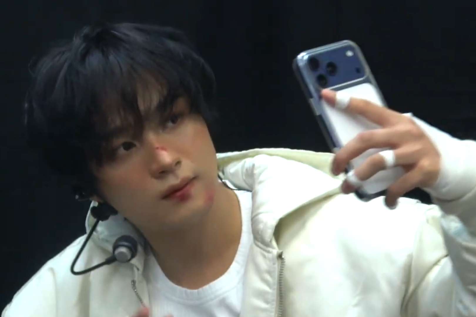 [잡담] 해찬이 나이 먹을수록 상처 분장하면 더 귀여워짐 | 인스티즈