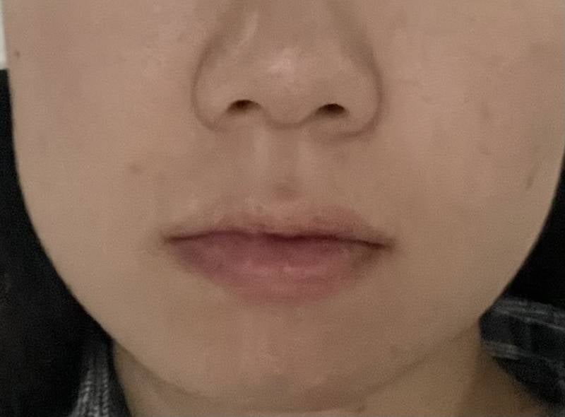 [잡담] 볼살 있는 편이니..? | 인스티즈