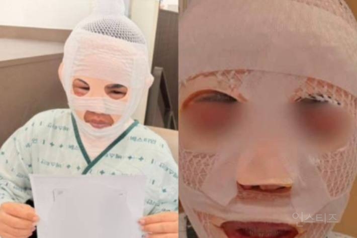 작년 태국인 아내 커피포트 끓는 물 사건 결과.txt | 인스티즈