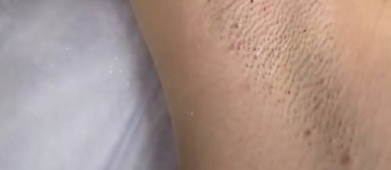 [잡담] ㅎㅇㅈㅇ)))) 겨드랑이 | 인스티즈