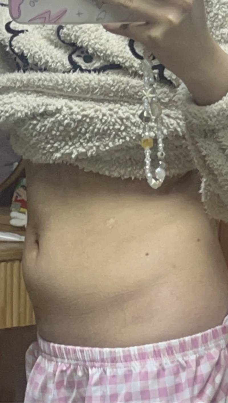 [잡담] 뱃살 복부비만 수준이야.? | 인스티즈