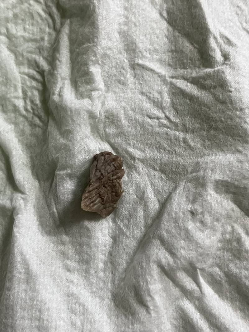 [잡담] 10년 묵은 배꼽때 팝니다 사진있음 (ㅎㅇㅈㅇ) | 인스티즈