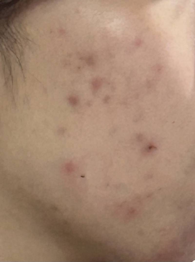 [잡담] 얘들아 진짜 옆으로 누워자지 마라 | 인스티즈