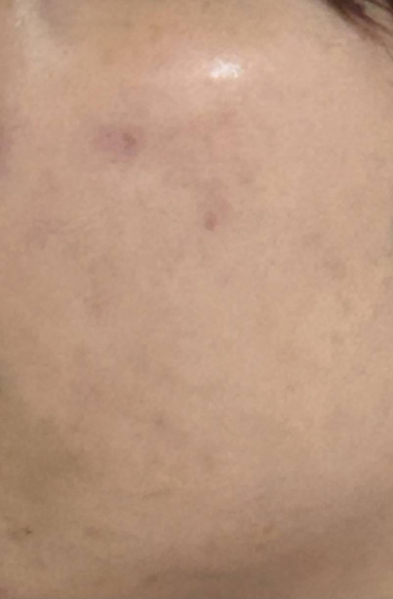 [잡담] 얘들아 진짜 옆으로 누워자지 마라 | 인스티즈