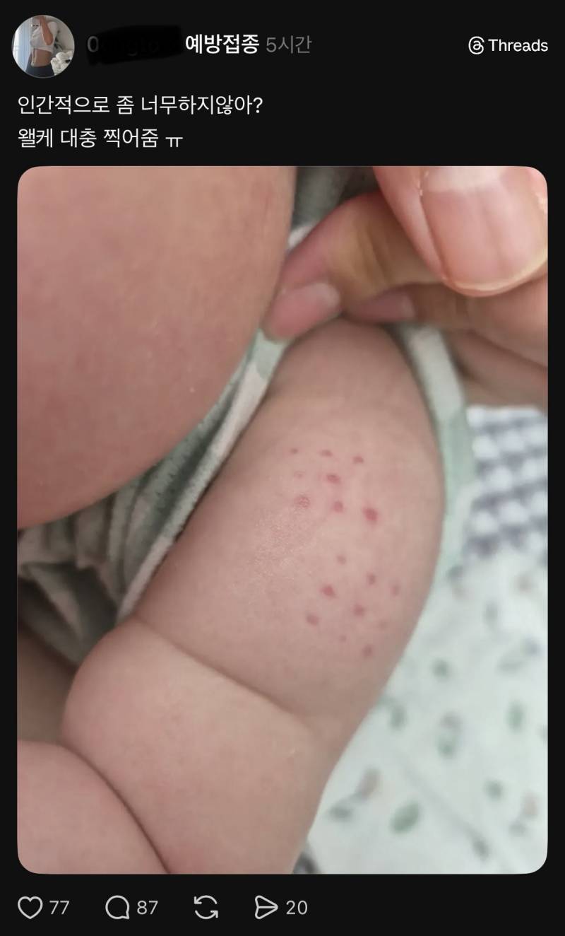 현재 스레드에서 논란인 아기 불주사 자국..JPG | 인스티즈