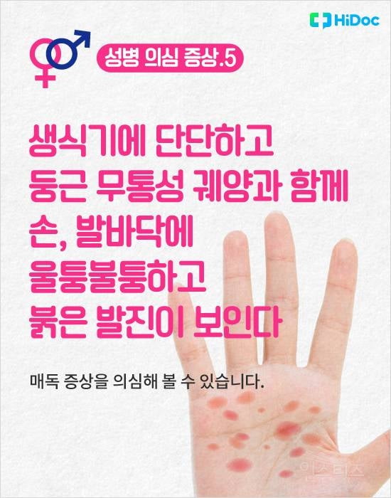 혹시 나도? 대표적인 성병 의심 증상 8가지 | 인스티즈