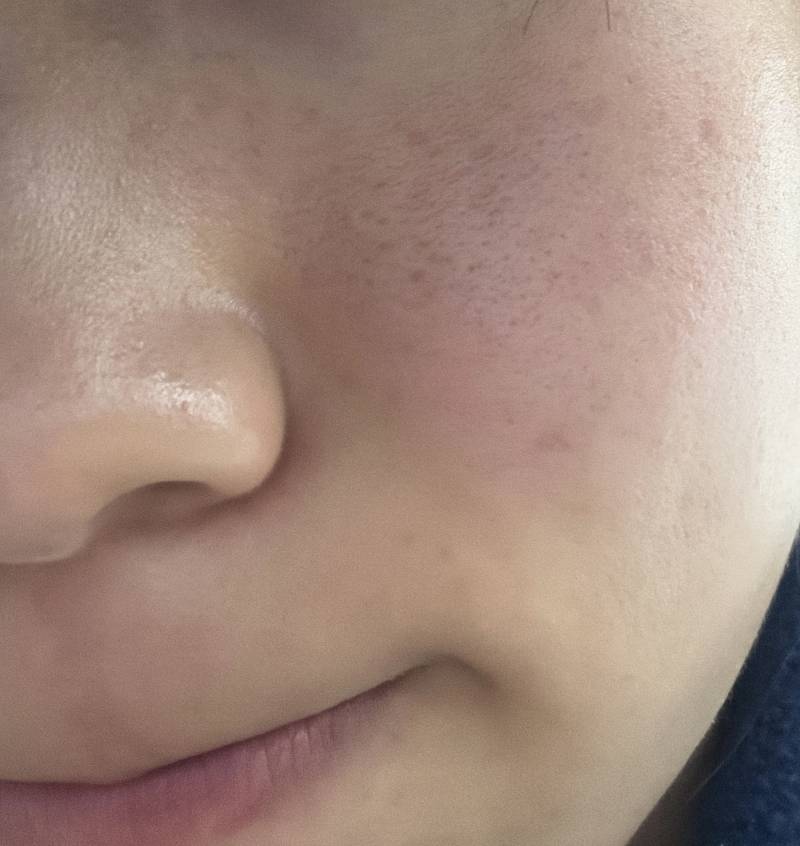 [잡담] 진짜 이런 피부는 뭐 어떻게 해야행애애어 | 인스티즈