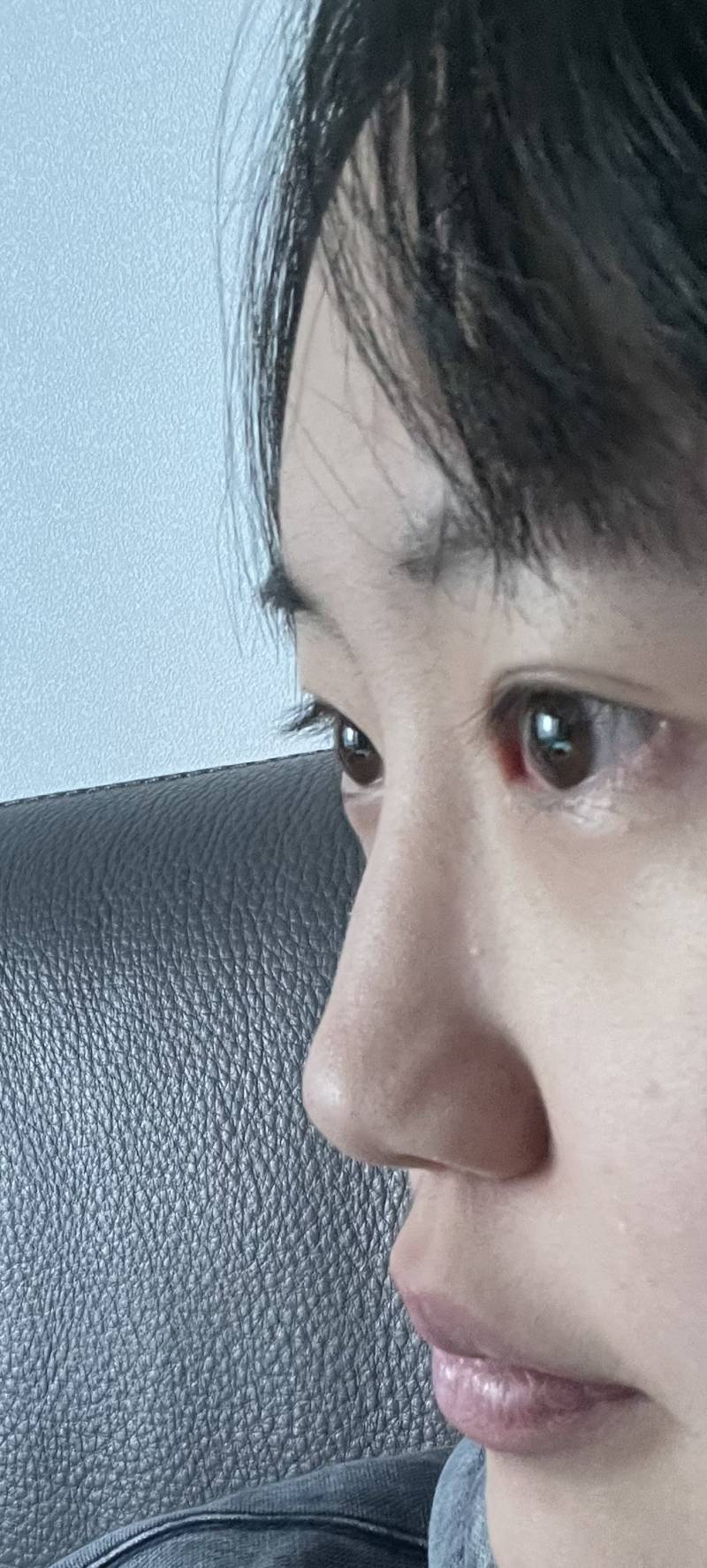 [잡담] 코수술하면 좋겠지?ㅠ | 인스티즈