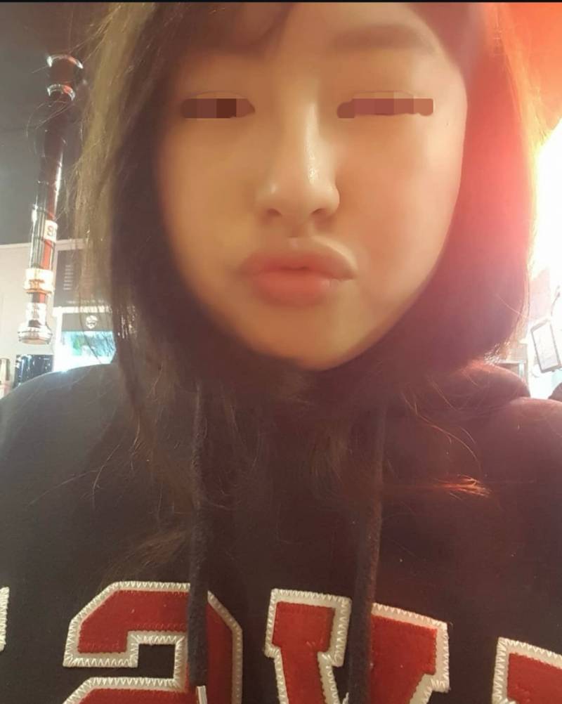 [잡담] 서른살 피부만 좋은 익인이 슴셋때 사진 들고옴 동안 호소글 아님 | 인스티즈