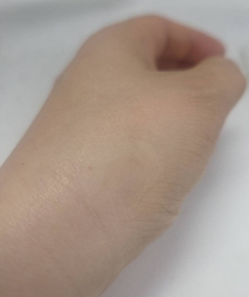 [잡담] 손에 주사 맞았는데 주사스티커 붙혀주신 위치 웃김 ㅋㅋ | 인스티즈