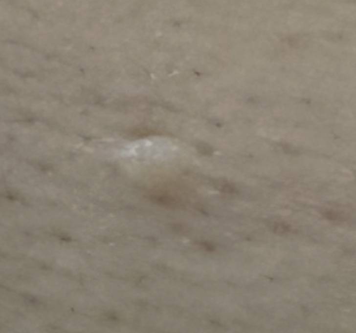 [잡담] 볼에 난 걷데 무ㅓ야?? | 인스티즈