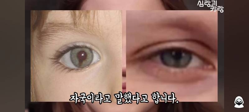 [잡담] 동공이 이런건 왜그런거야? | 인스티즈