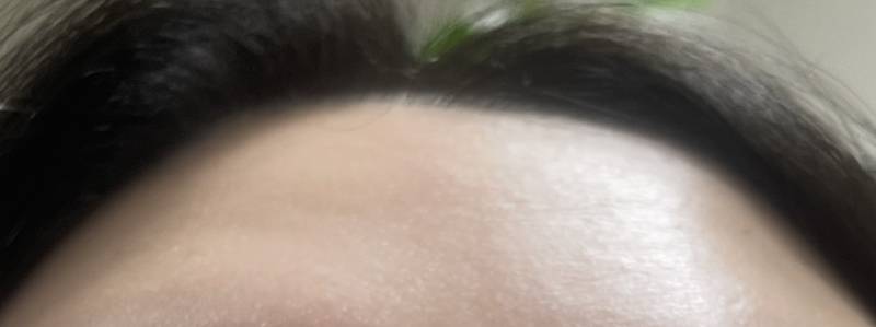 [잡담] 건성 좁쌀 예민 피부 익들 제발 라로슈포제 밤 써줘... | 인스티즈