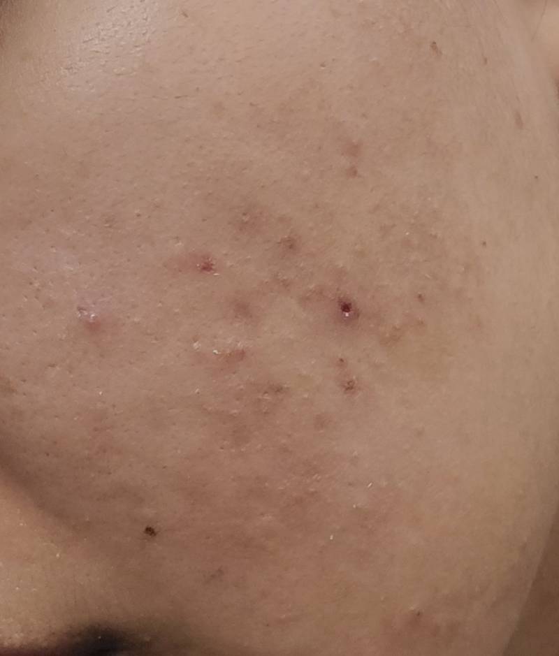 [잡담] 피부 이런거 어떻게 관리해야하냐.... | 인스티즈