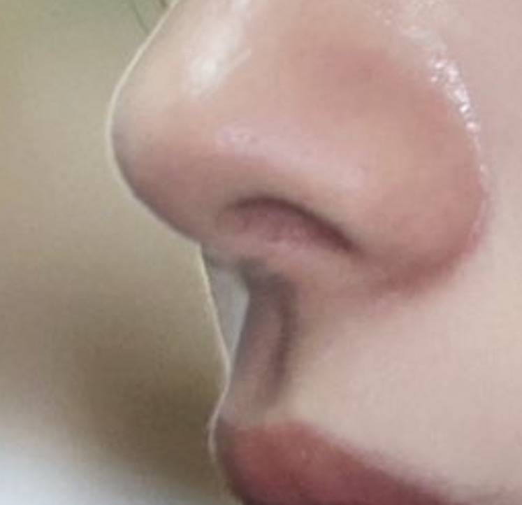 [잡담] 이거 코 성형한건가? | 인스티즈