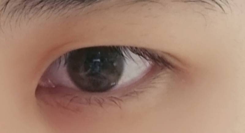 [잡담] 쌍수하면 괜찮을 눈일까? | 인스티즈