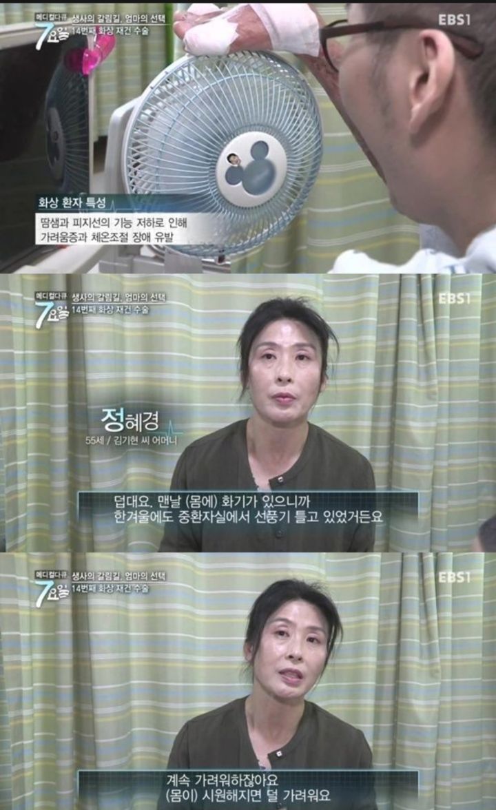 화상 환자들이 겪는 고통..jpg | 인스티즈