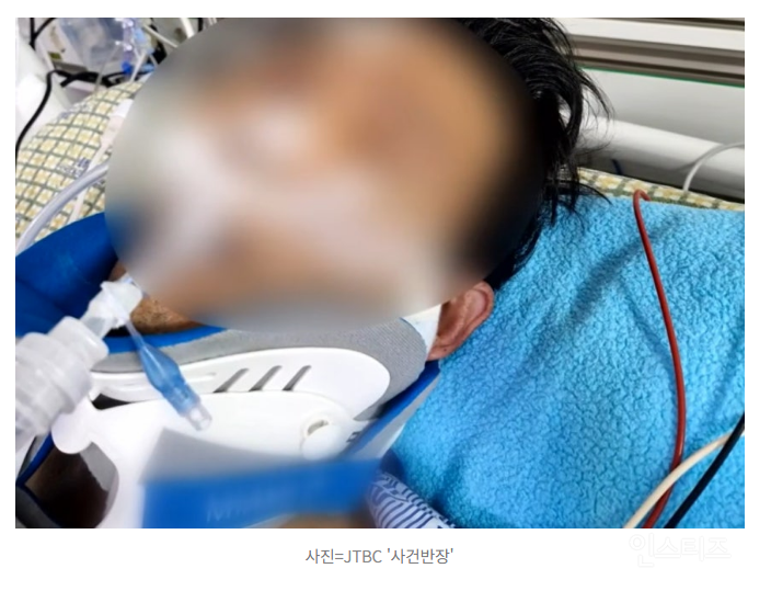 "휠체어도 탈 수 없다"...침 뱉고 무차별 폭행, 50대 가장 '사지마비' | 인스티즈
