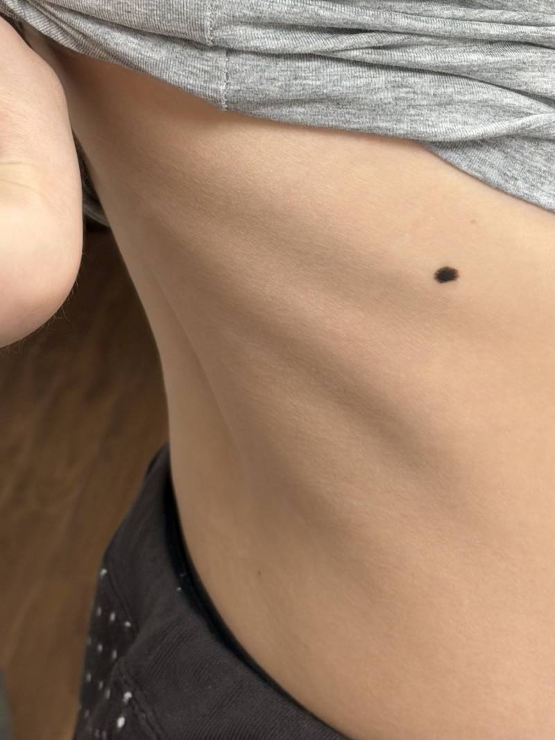 [잡담] 이거 뼈 비치는건가.? 징그럽냐 | 인스티즈