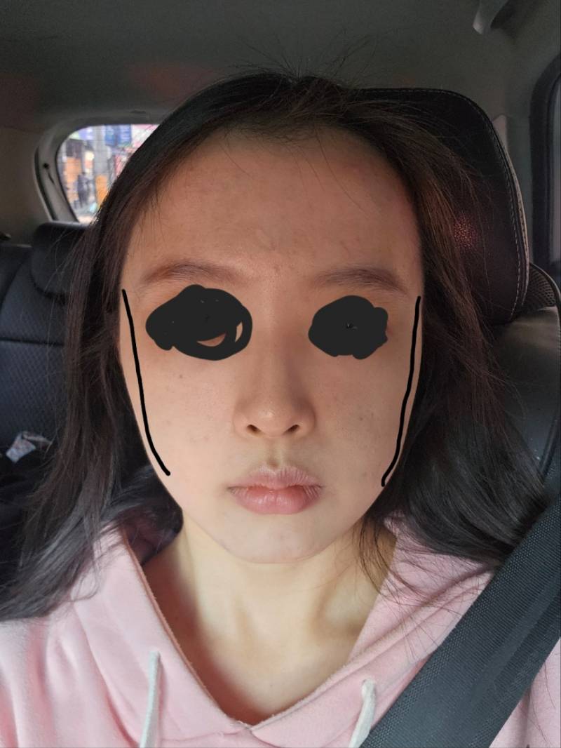 [잡담] 사진처럼 얼굴 옆 여백만 줄이고 싶은데 | 인스티즈