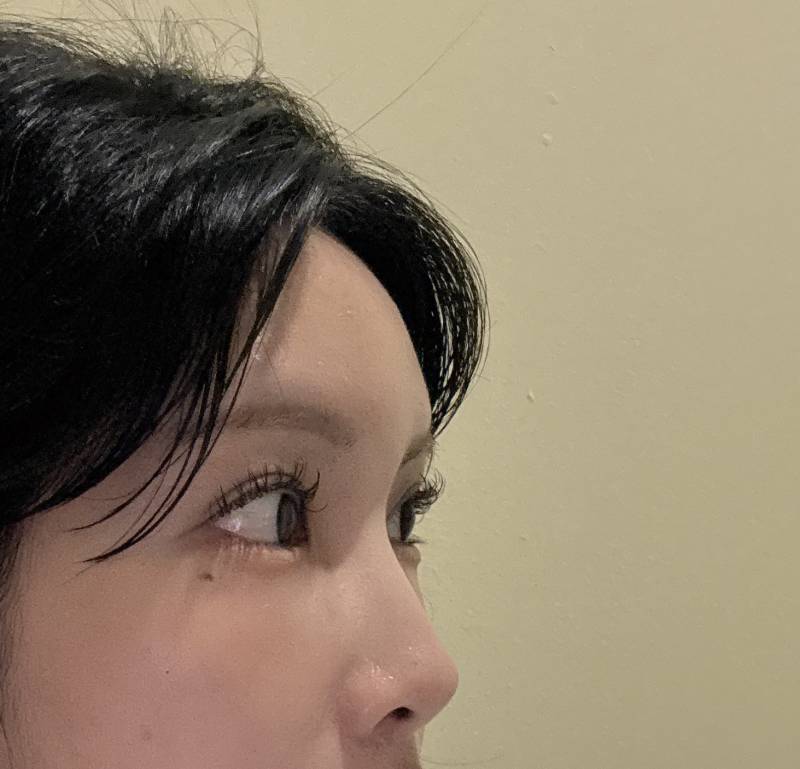 [잡담] 이뿌니덜 ,, 나 코끝 수술하면 갠차늘거같아...? | 인스티즈