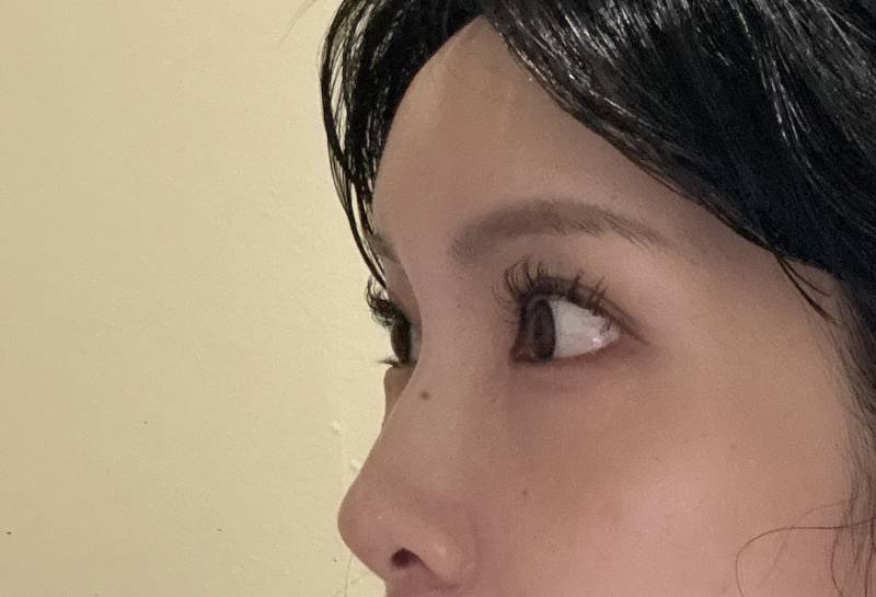 [잡담] 이뿌니덜 ,, 나 코끝 수술하면 갠차늘거같아...? | 인스티즈