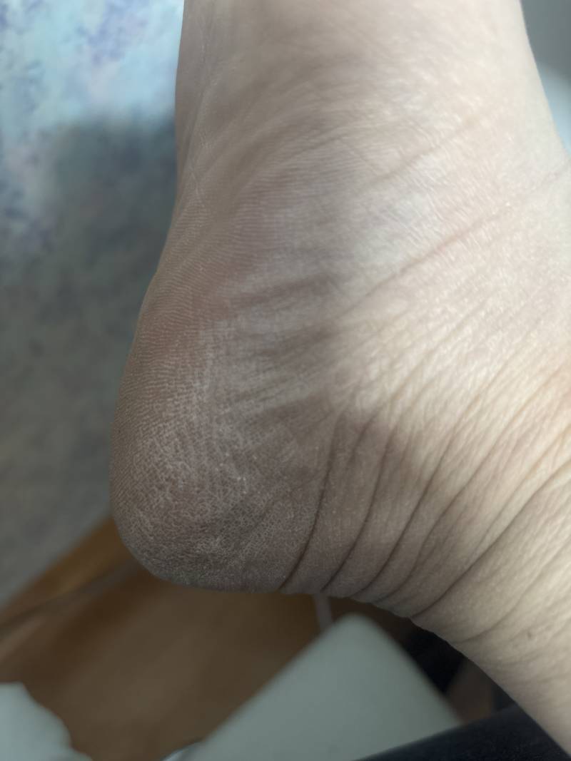 [잡담] 다들발이럼? | 인스티즈