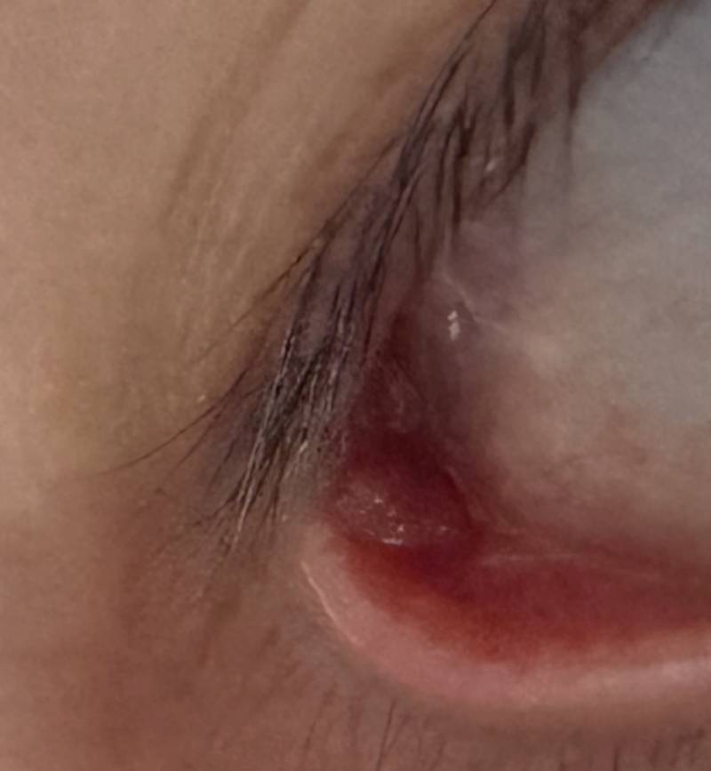 [잡담] 익들이라면 이거 쨀래? 혐주의 | 인스티즈
