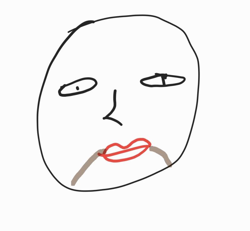 [잡담] 입꼬리 끝부터 턱까지 색소침착 있는 사람? | 인스티즈