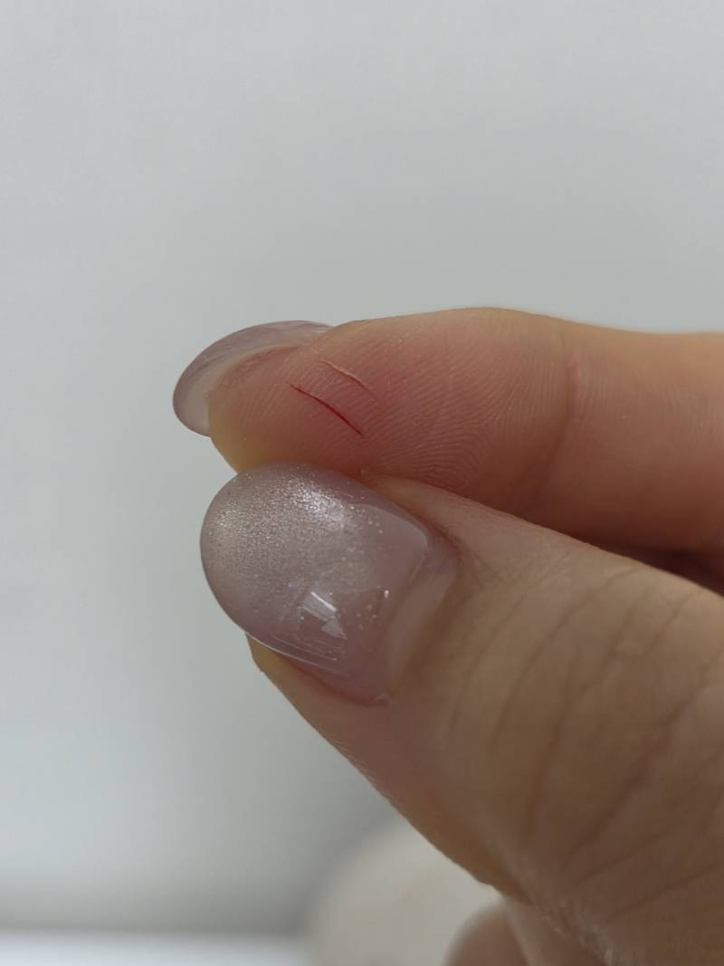 [잡담] 오 대박 카페컵 분리수거 하려고 뚜껑 열다가 손가락 파임 ㅎㅇㅈㅇ | 인스티즈