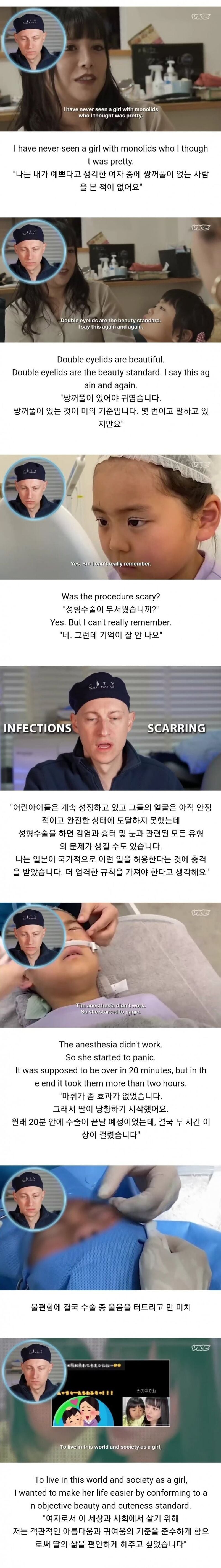 성형수술 받는 일본 어린 아이들.jpg | 인스티즈