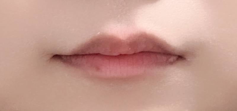 [잡담] 입술 필러 너무너무 맞고싶어 | 인스티즈