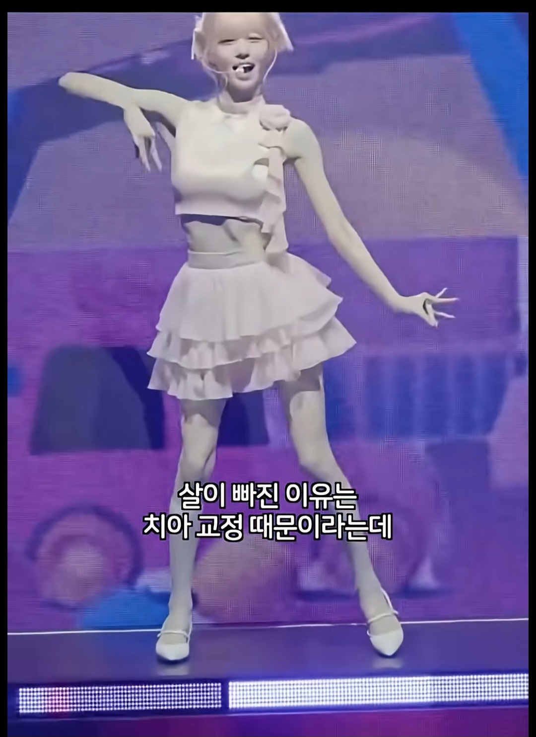 [잡담] 거식증이 아니라 치아교정 때문에 살빠진거래 | 인스티즈