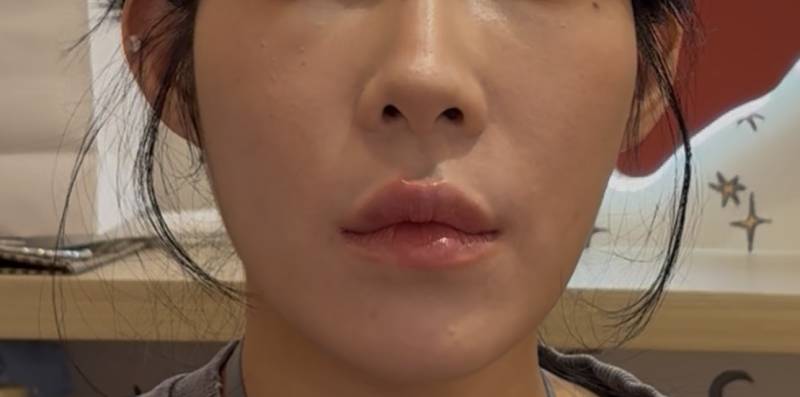 [잡담] 익들 나 진지하게 옆볼필어녹일까..?ㅠㅠ | 인스티즈