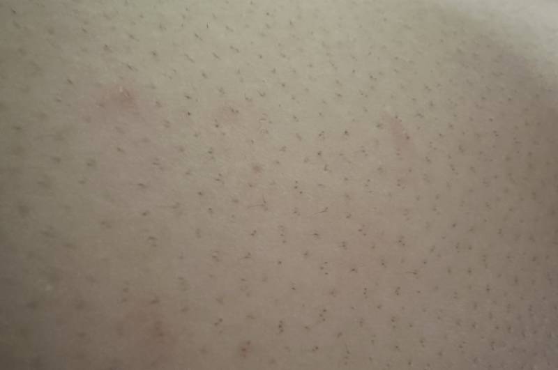 [잡담] (ㅎㅇㅈㅇ)이거 인그로운헤어지?? | 인스티즈